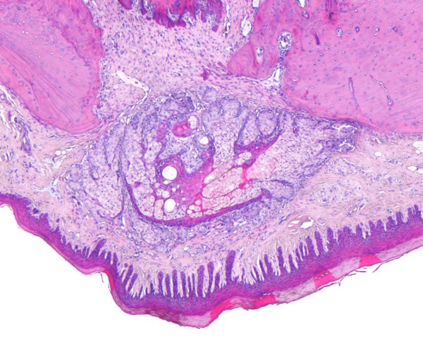 Case #10, Fig. 1