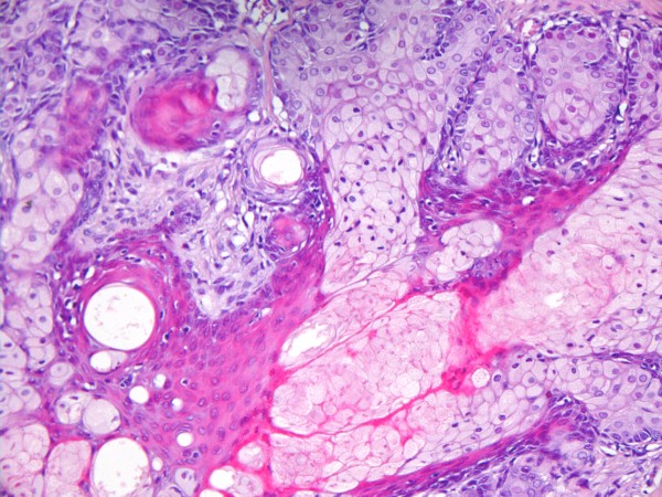 Case #10, Fig. 2