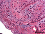 Case 11, Fig. 2