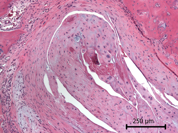 Case #11, Fig. 4