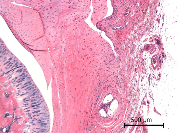 Case #11, Fig. 5