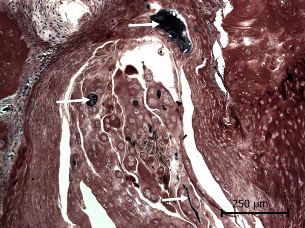 Case #11, Fig. 6