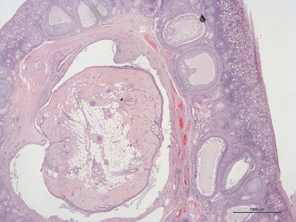 Case #14, Fig. 1