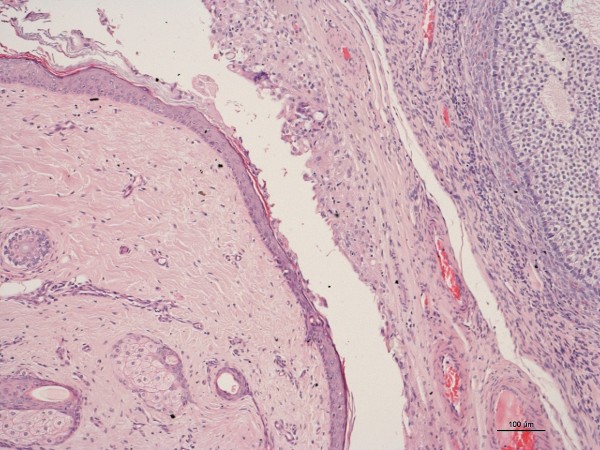 Case #14, Fig. 2