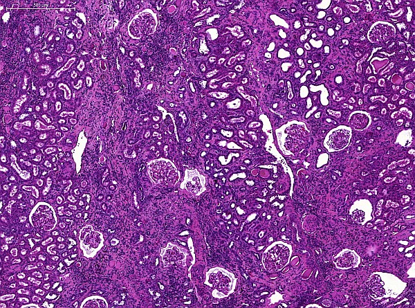 Case #15, Fig. 1