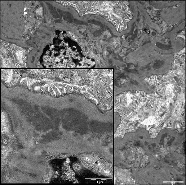 Case #15, Fig. 7