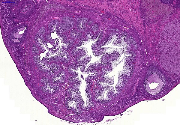 Case #16, Fig. 1