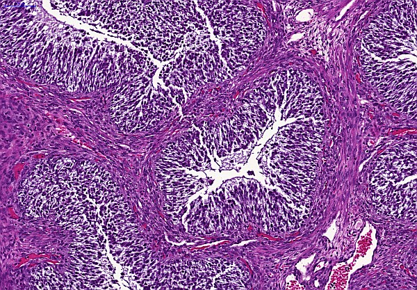 Case #16, Fig. 2