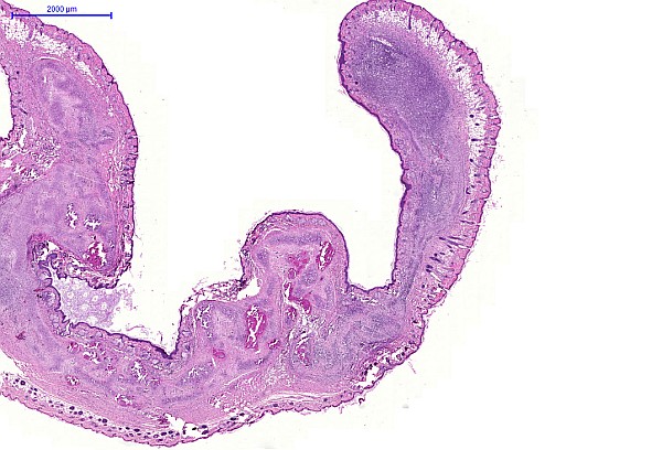 Case #19, Fig. 1