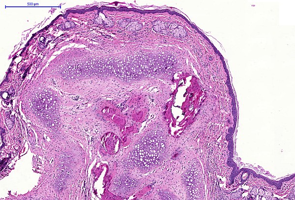 Case #19, Fig. 2