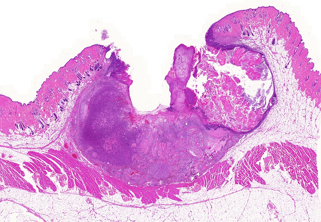 Case #20, Fig. 2