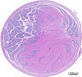 Case 20, Fig. 1