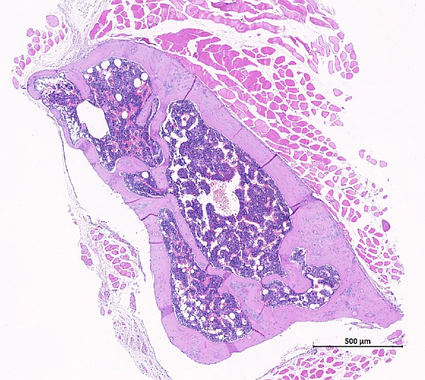 Case #23, Fig. 3