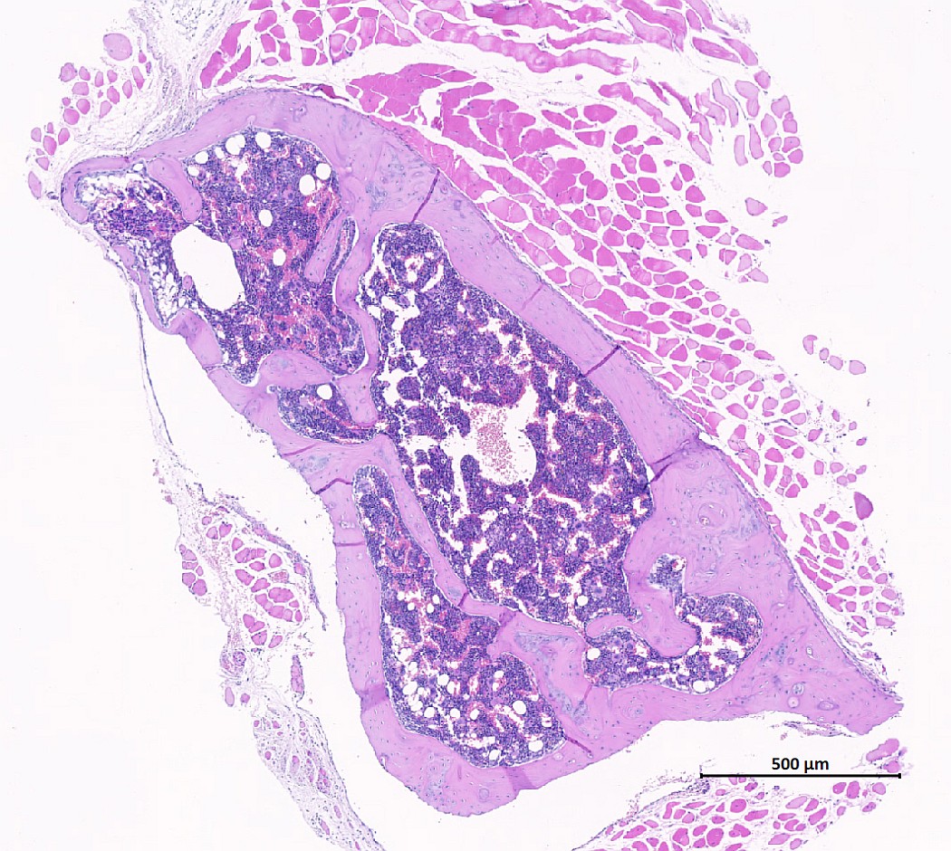 Case #23, Fig. 3