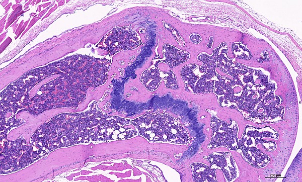 Case #23, Fig. 5