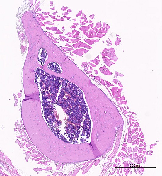 Case #23, Fig. 6