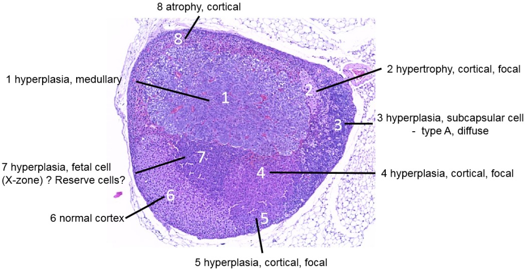 Case #25, Fig. 1