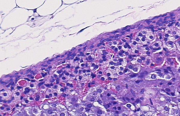 Case #25, Fig. 16