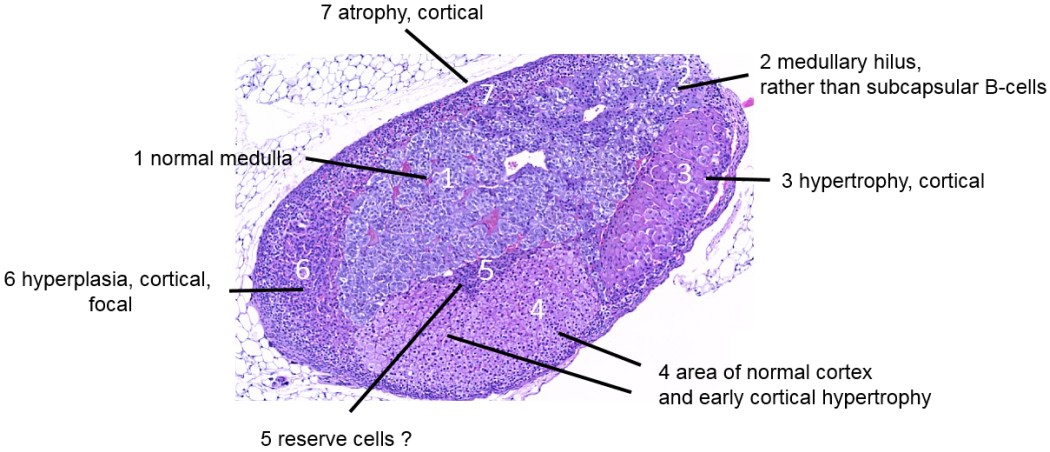 Case #25, Fig. 2