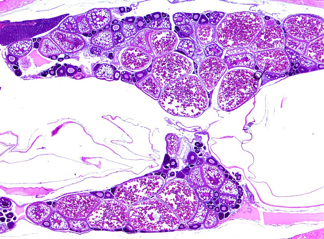 Case #26, Fig. 1