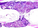 Case 20, Fig. 1