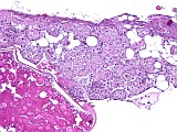 Case 20, Fig. 1