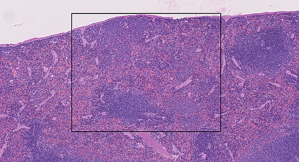 Case #28, Fig. 7