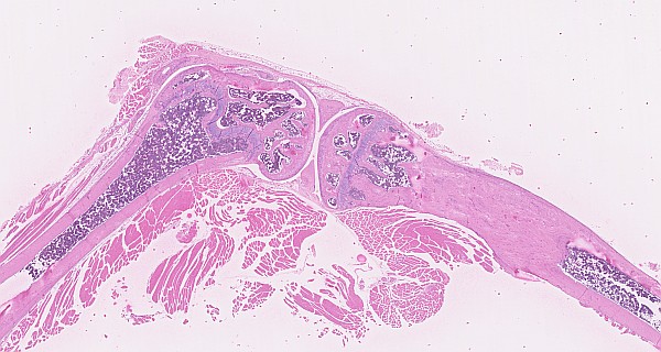 Case #30, Fig. 1