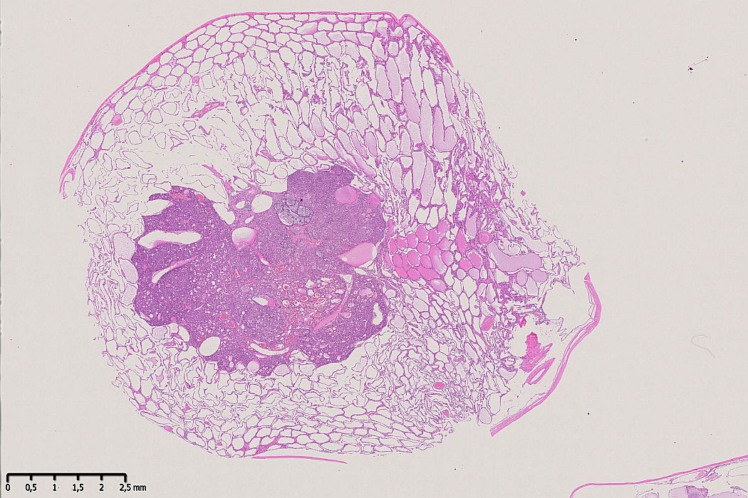 Case #31, Fig. 1