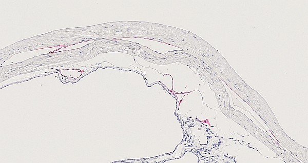 Case #31, Fig. 19