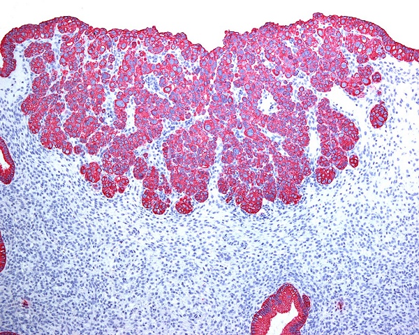 Case #4, Fig. 4