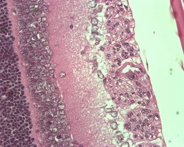 Case #5, Fig. 4