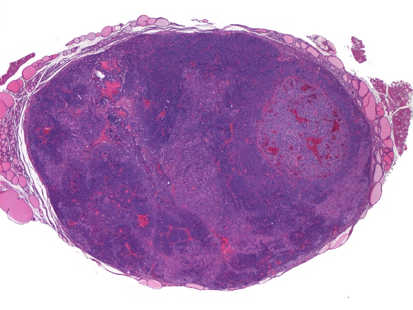 Case #7, Fig. 1