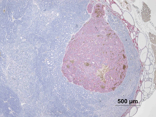 Case #7, Fig. 6