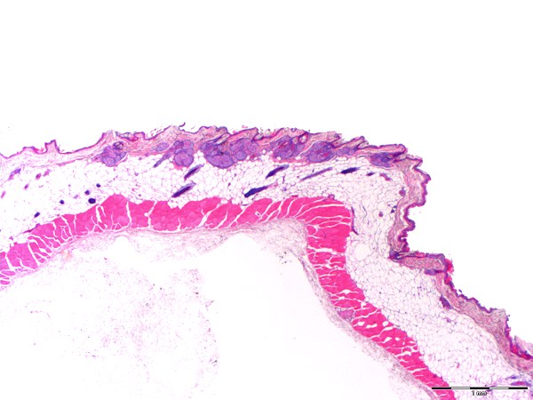 Case #8, Fig. 1