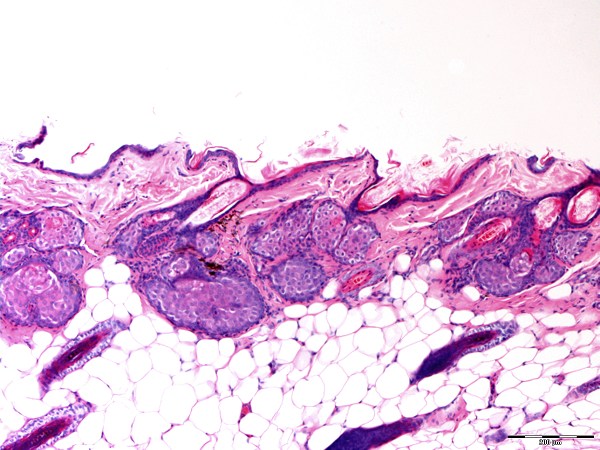 Case #8, Fig. 2