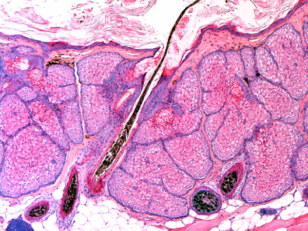 Case #8, Fig. 6