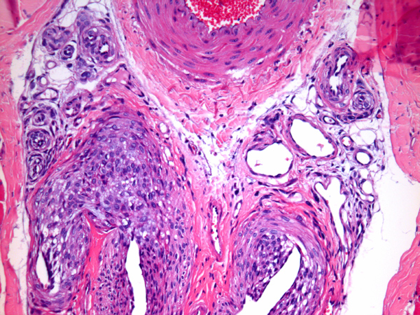 Case #9, Fig. 3