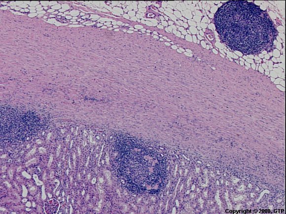 Case # 5, Fig. 1