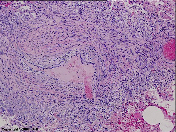 Case # 5, Fig. 2