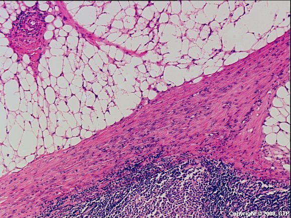 Case # 5, Fig. 4