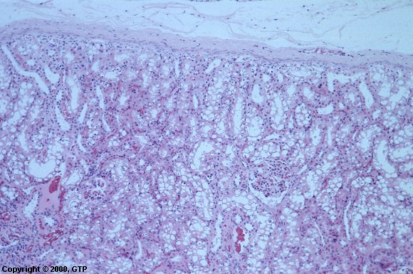 Case # 6, Fig. 1