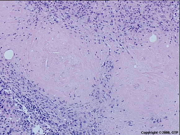 Case # 7, Fig. 2