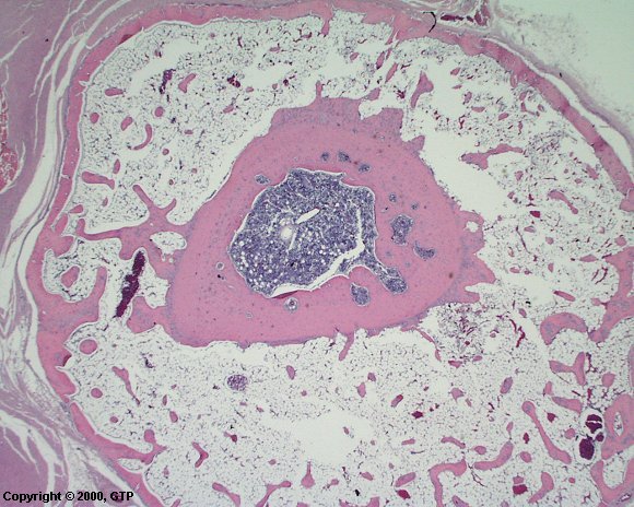 Case # 9, Fig. 1