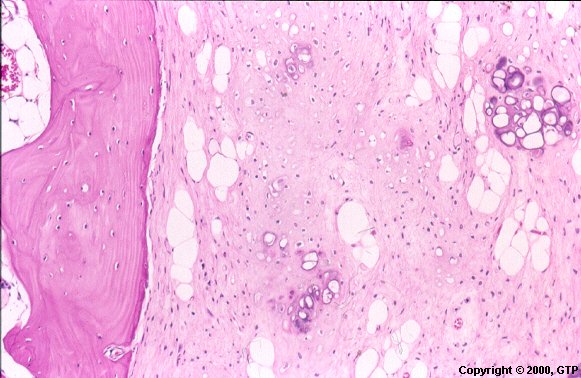 Case # 10, Fig. 2