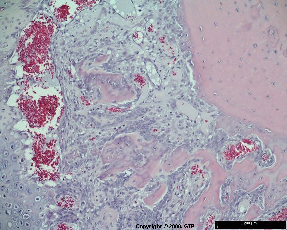 Case # 9, Fig. 2