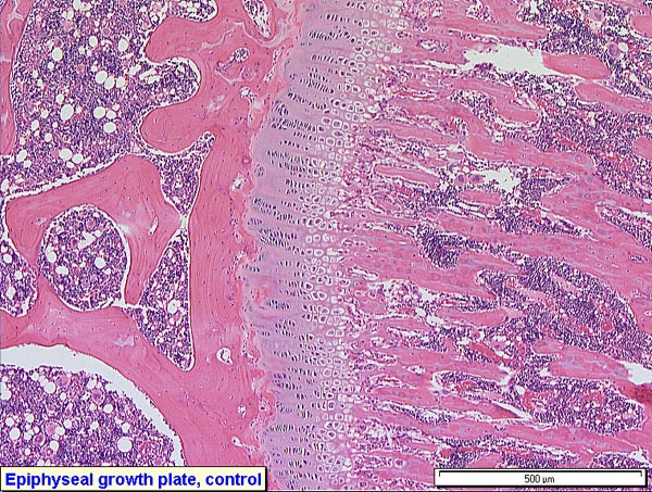 Case # 5, Fig. 1