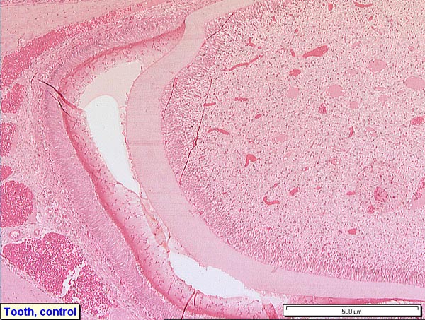 Case # 5, Fig. 3