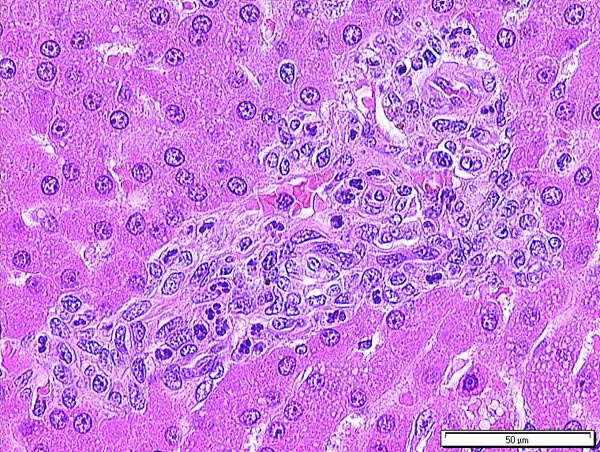 Case # 8, Fig. 2