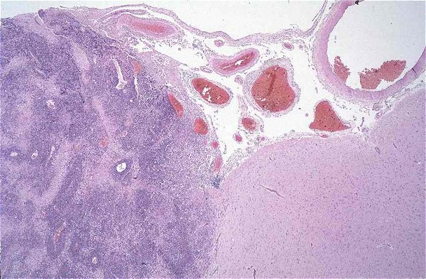 Case # 2, Fig. 1